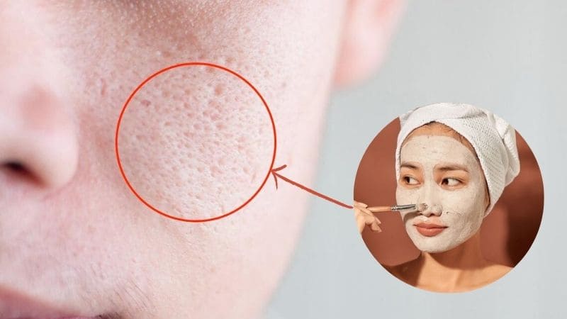 Đắp mặt nạ đất sét có tác dụng gì